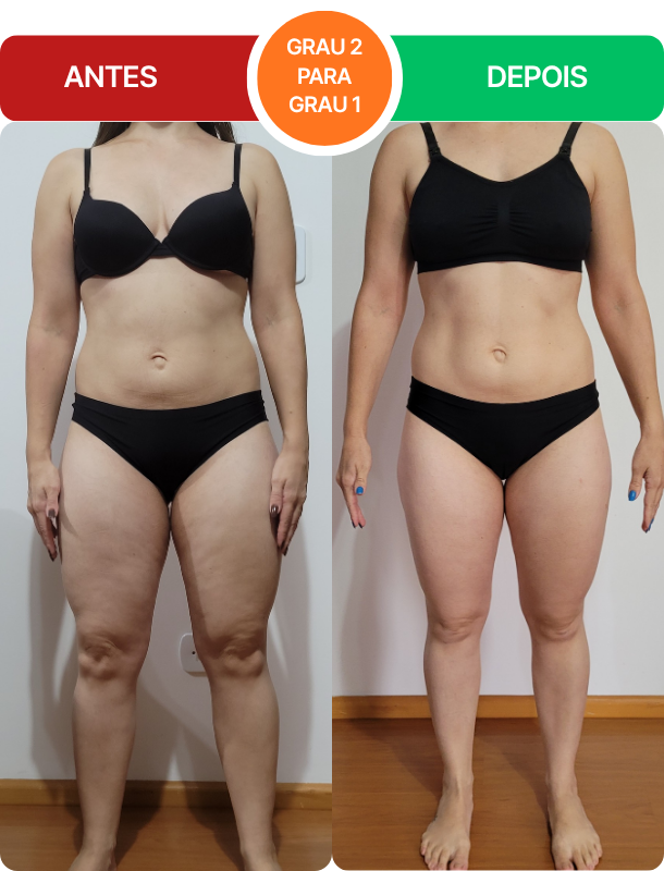 Antes e depois real de aluna do protocolo