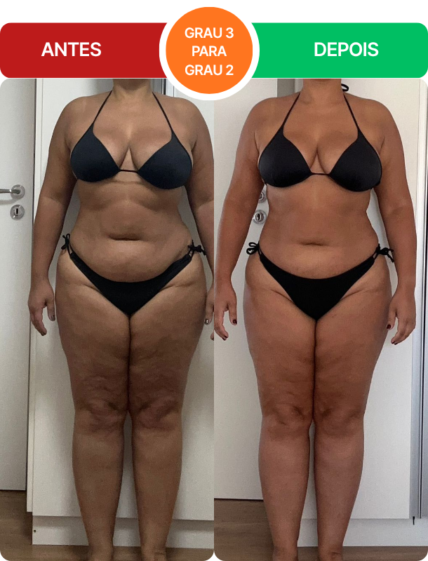 Antes e depois real de aluna do protocolo